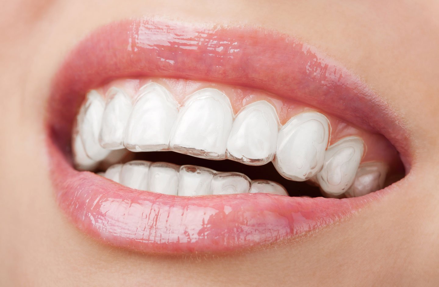 Finding a Trusted Dentist in St John's Wood for Quality Dental Care