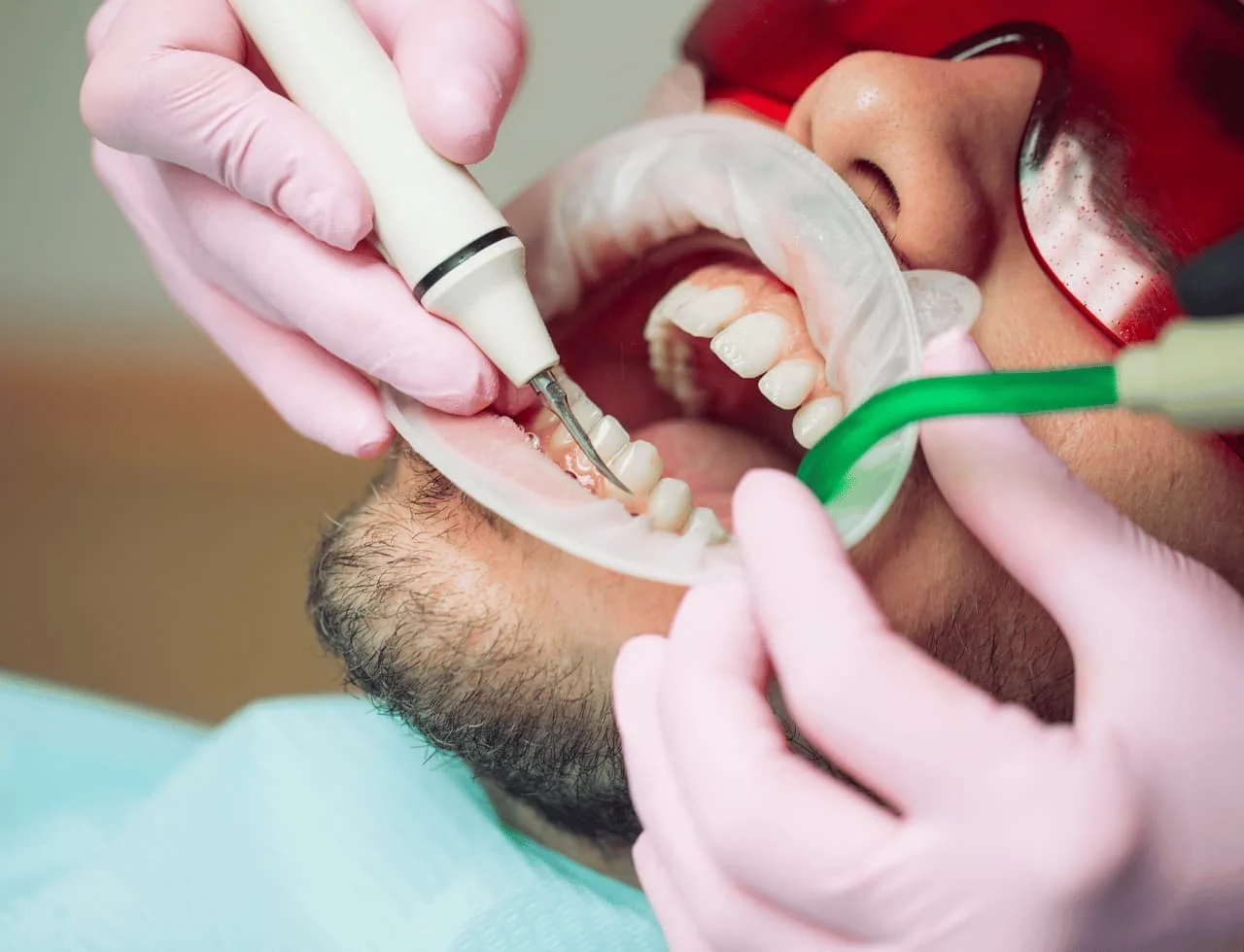 Signs You Need a Dental Marketing Service Now